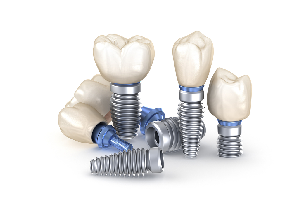Multiple Teeth Implants